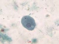 Entamoeba Coli