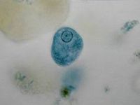 Entamoeba Hartmanni